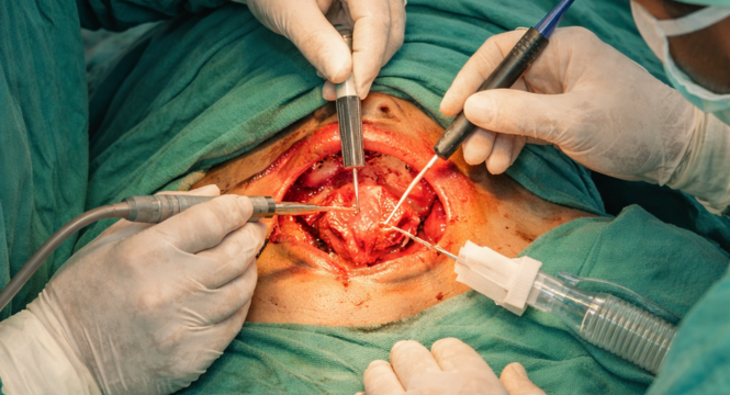 Thyroid and Neck Surgery